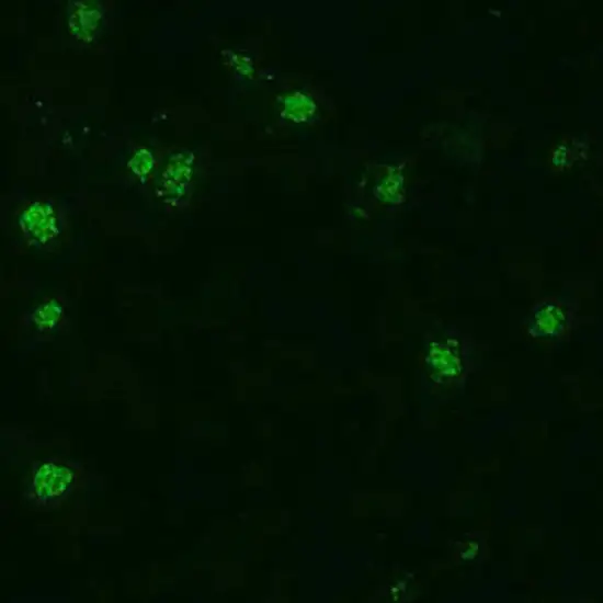 Card For Malaria (Malaria Serology)